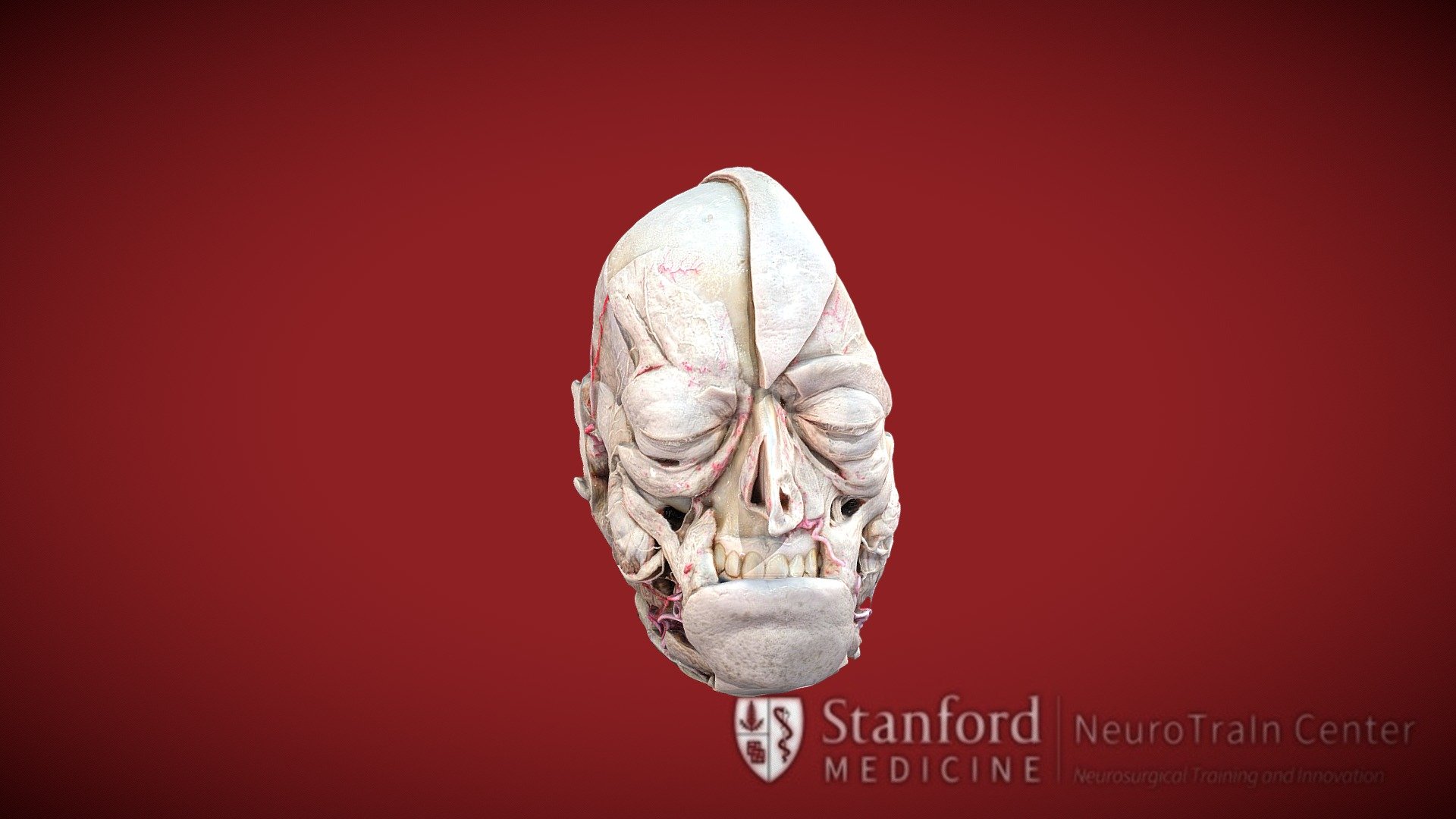 Hypotalamic nuclei 3d model