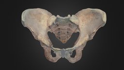 Android Pelvis