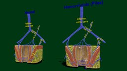 Piles hemorrhoids types