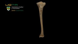 Tibia gauche / Left tibial bone