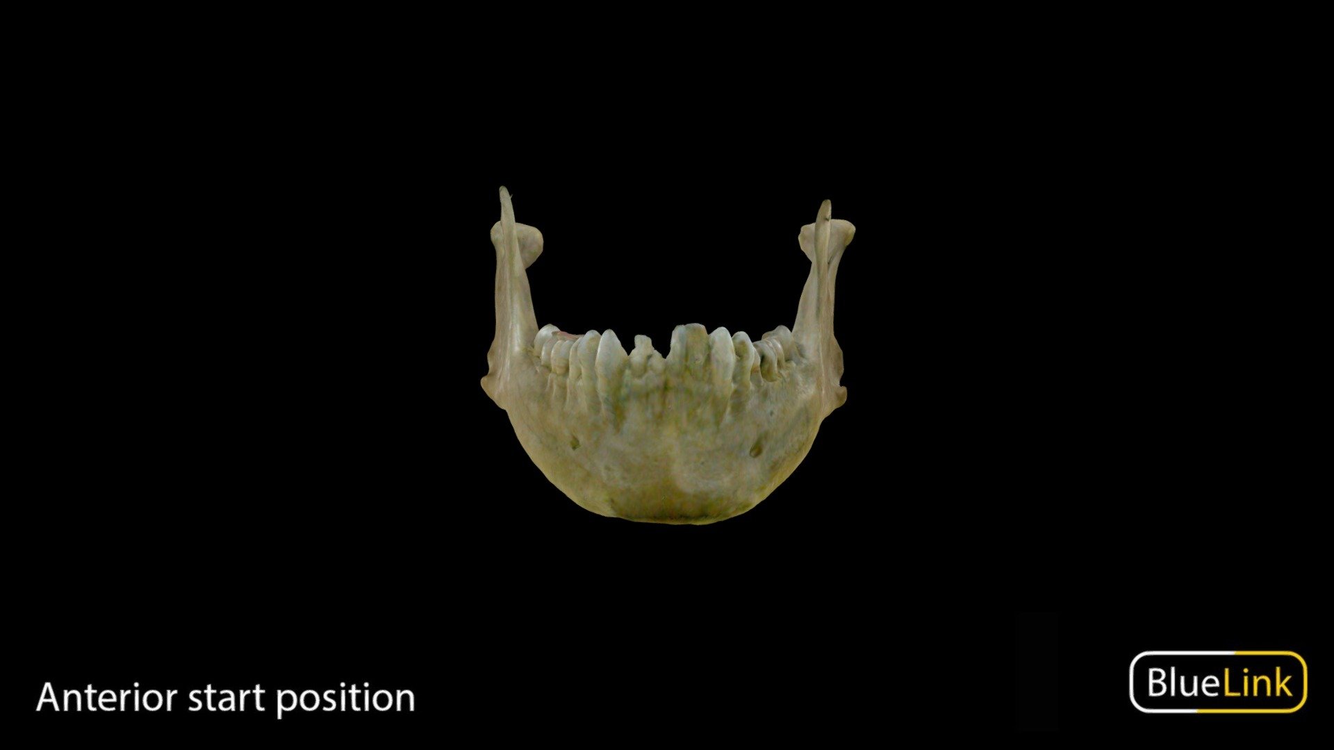 Mandible 3d model