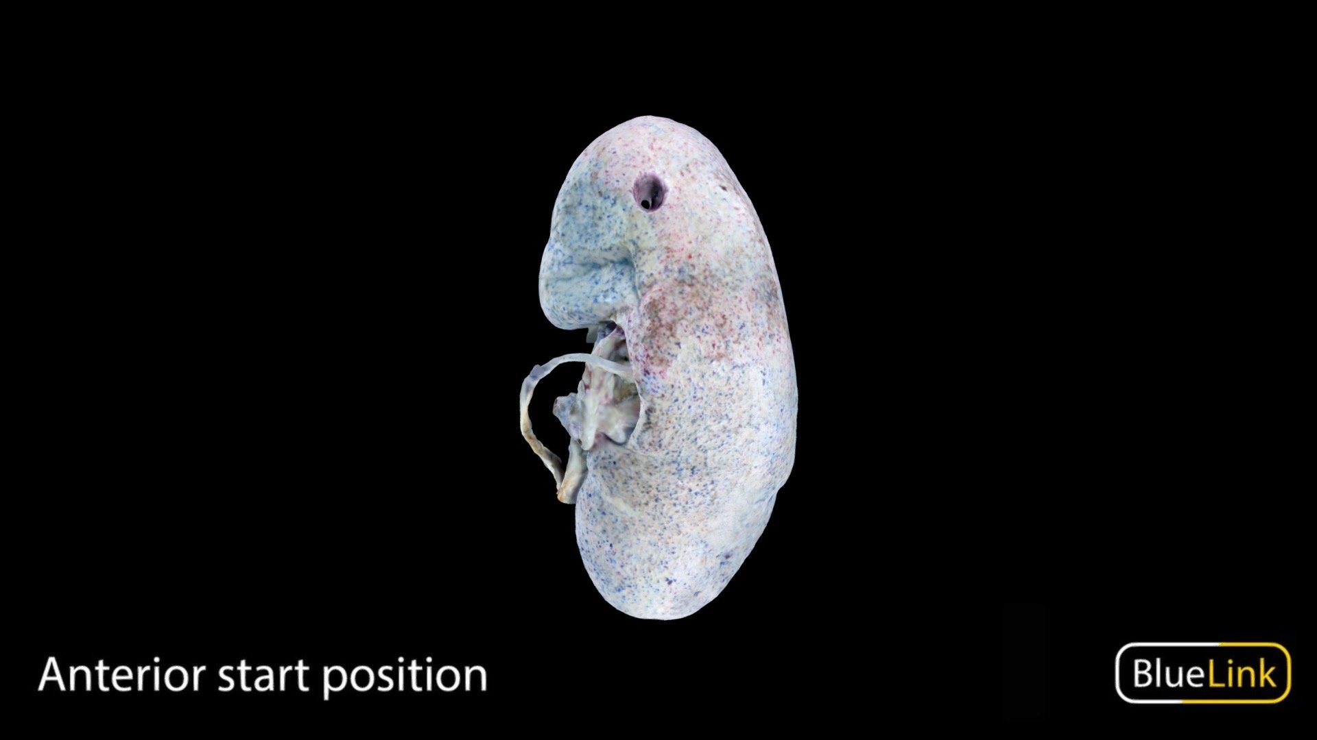 Bisected Colored Kidney 3d model