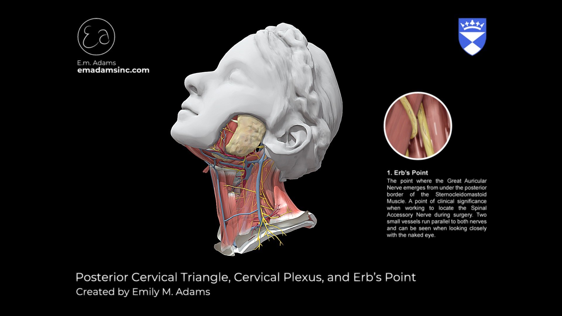 Posterior Cervical Triangle and Erbs Point 3d model