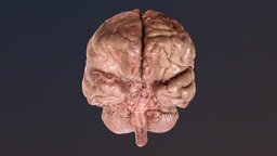 Brain