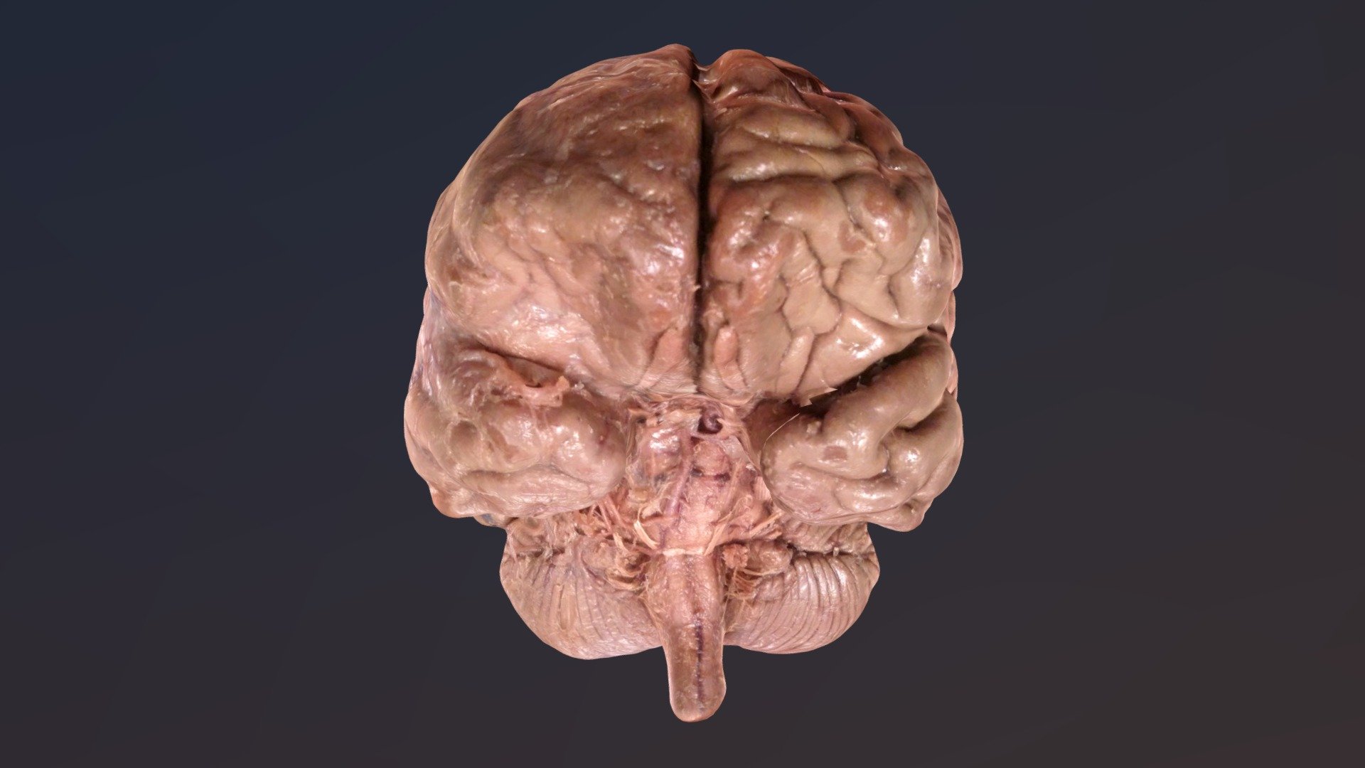 Brain 3d model