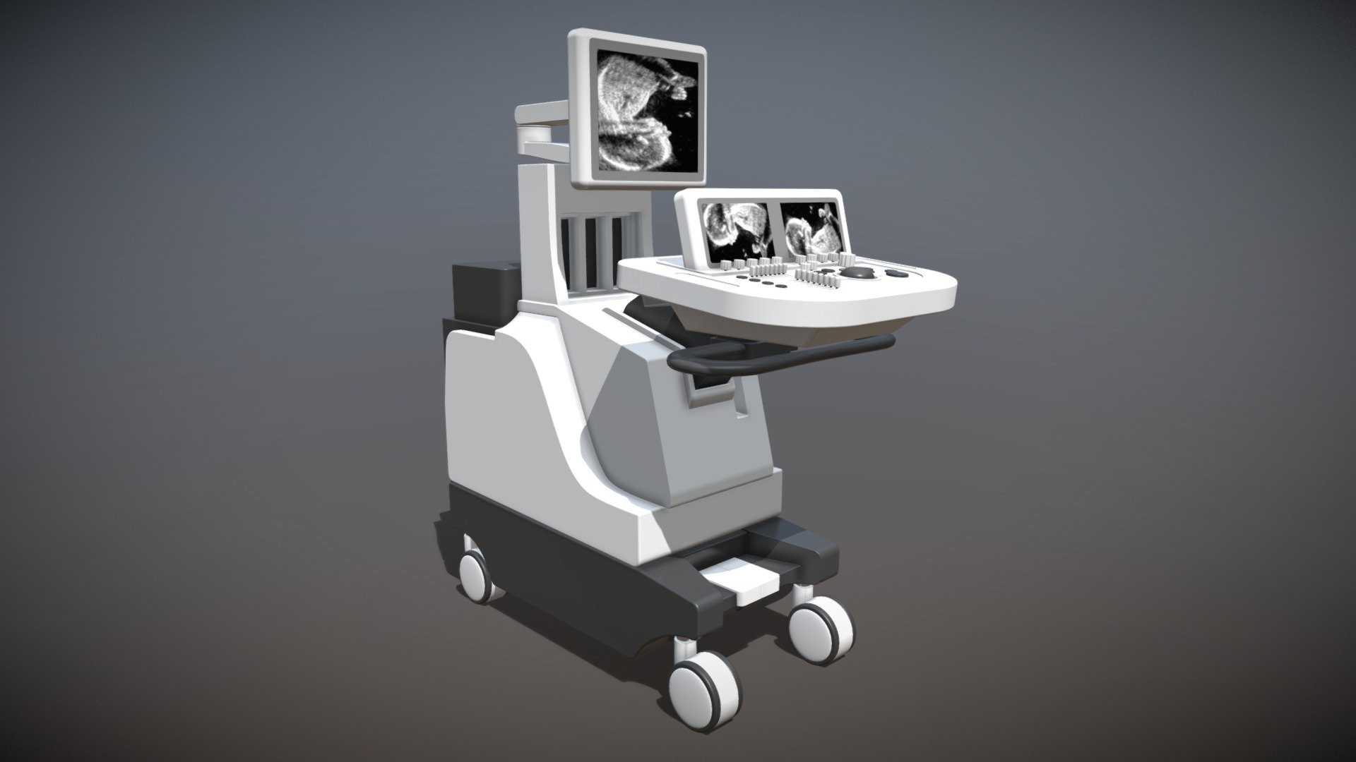 Ultrasound 3d model