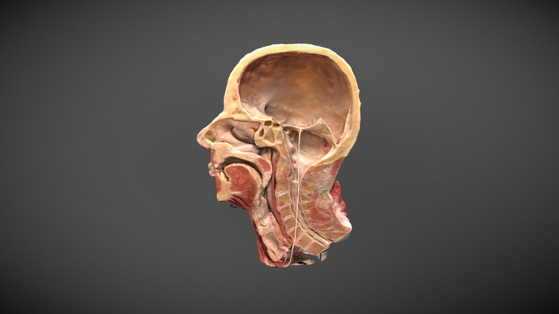 Plastination 001 3d model