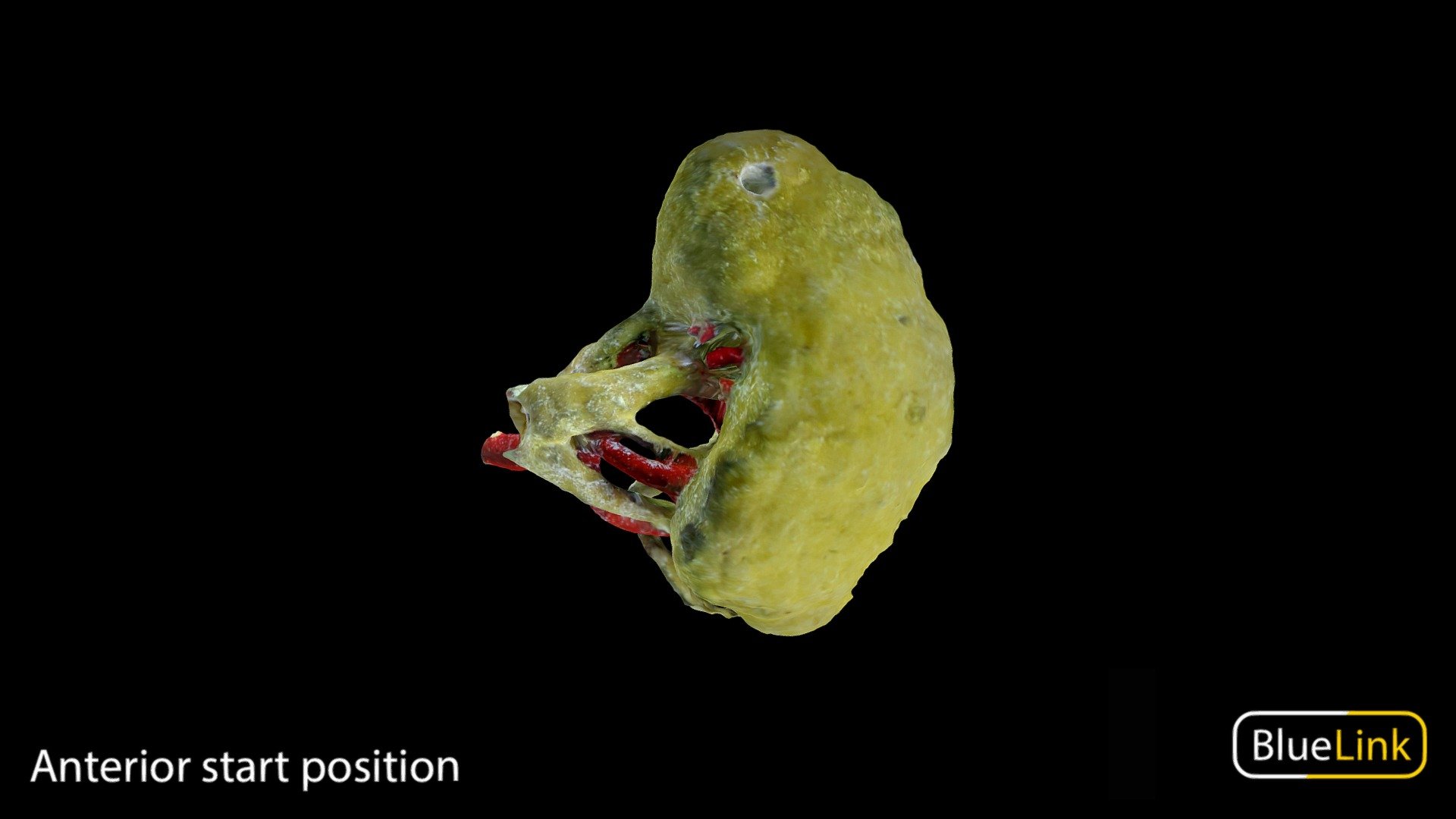 Whole Kidney- Left 3d model