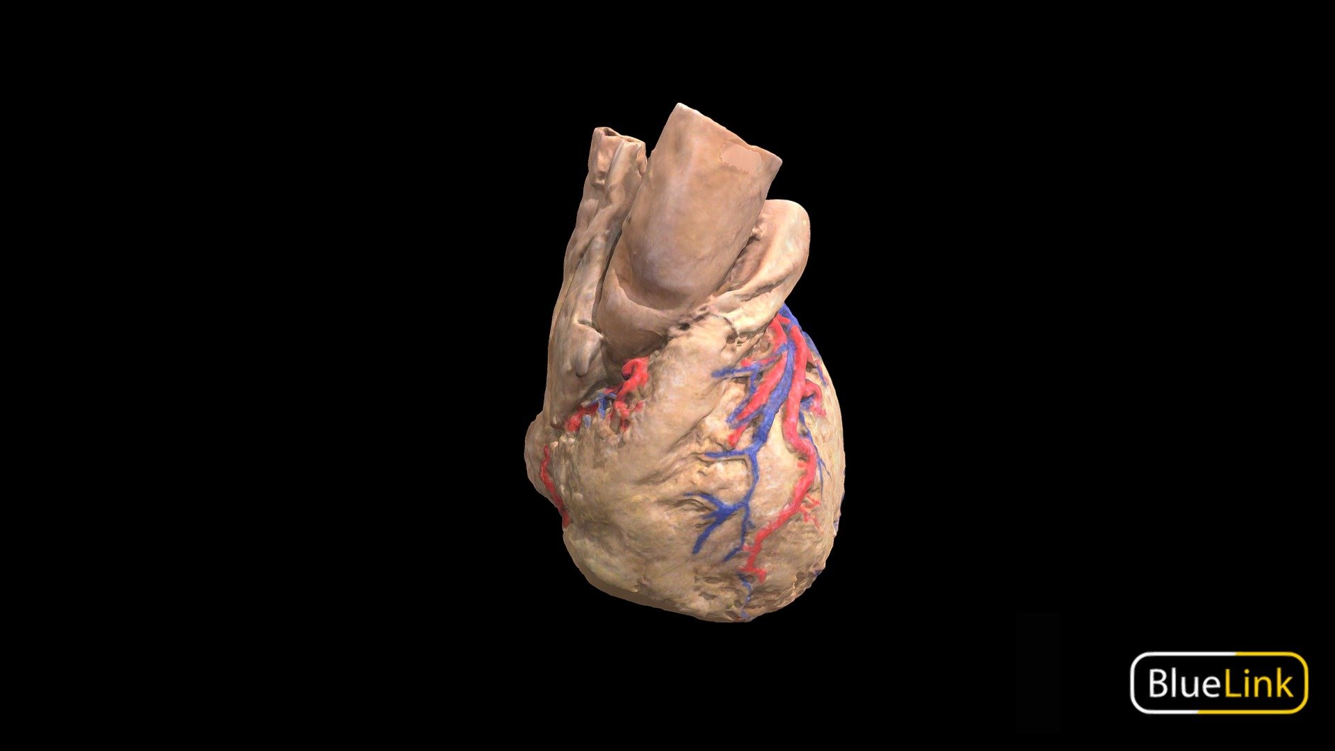 External Heart Vasculature 3d model