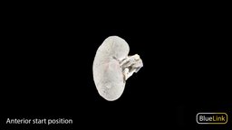 Whole Kidney