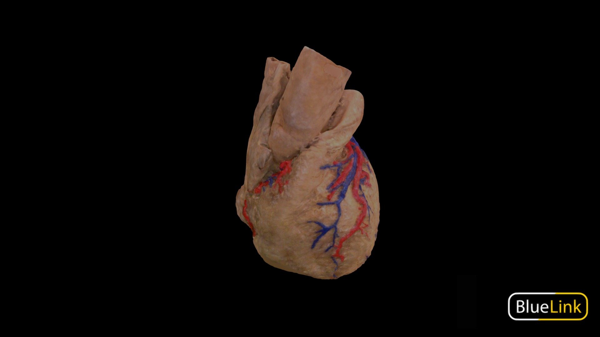 External Heart Vasculature 3d model