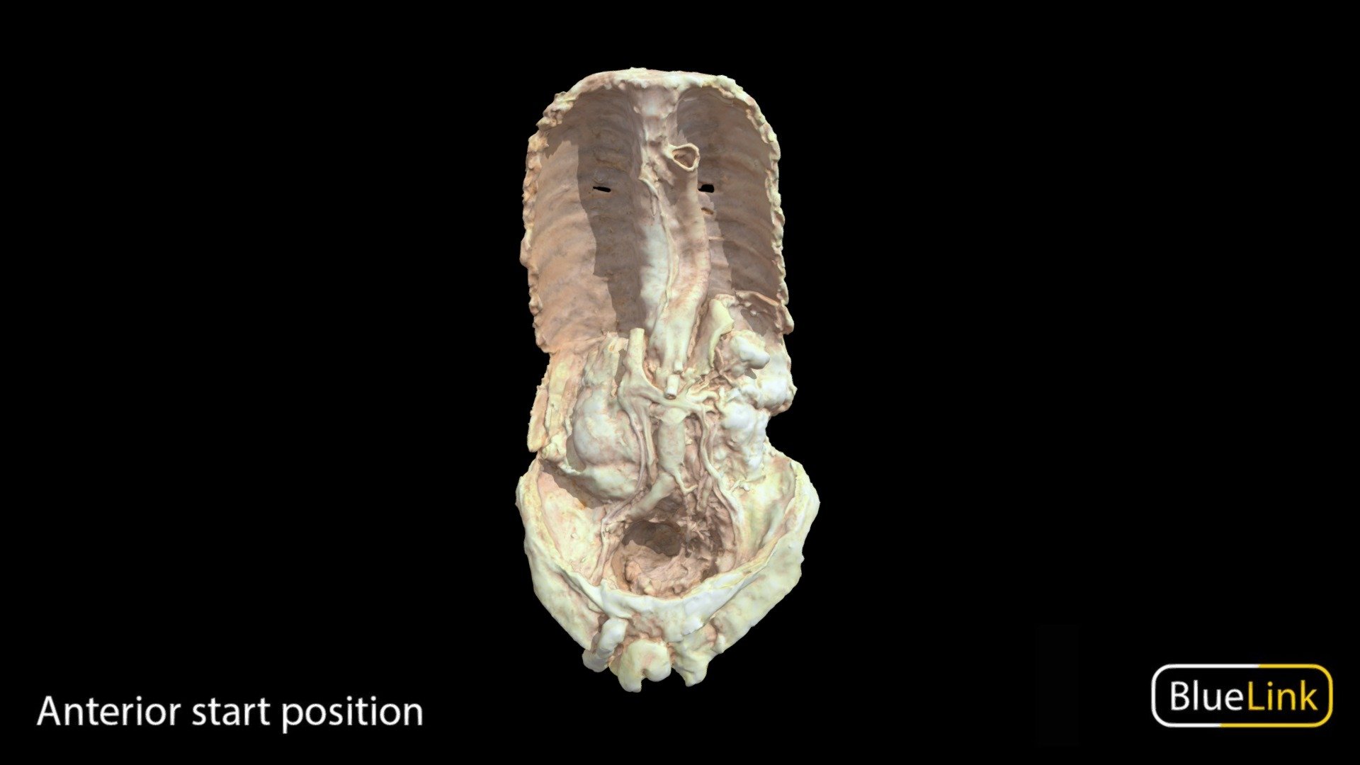 Abdominal Aorta 3d model