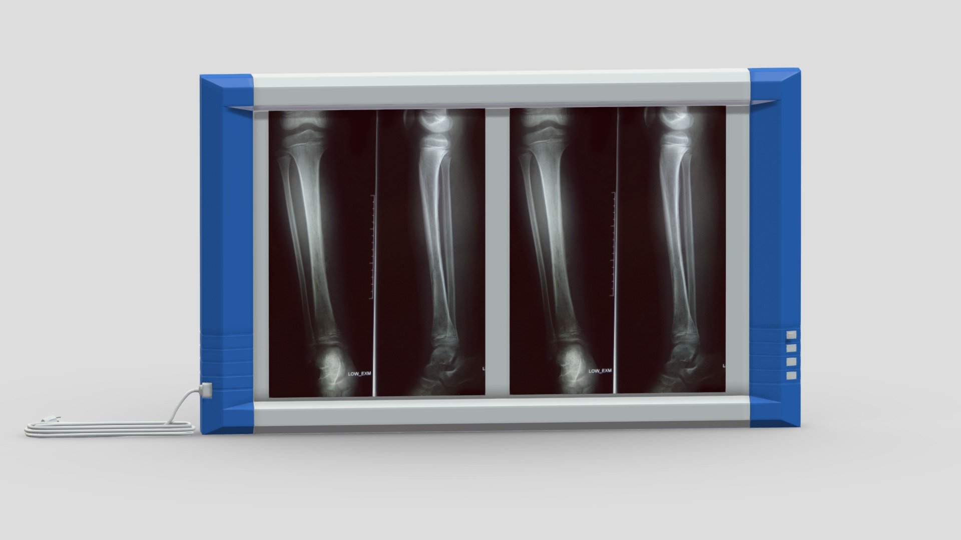 Medical X-Ray Light Box 3d model