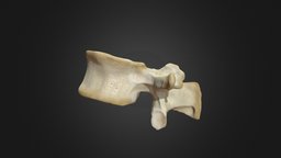 First Lumbar Vertebra (L1)