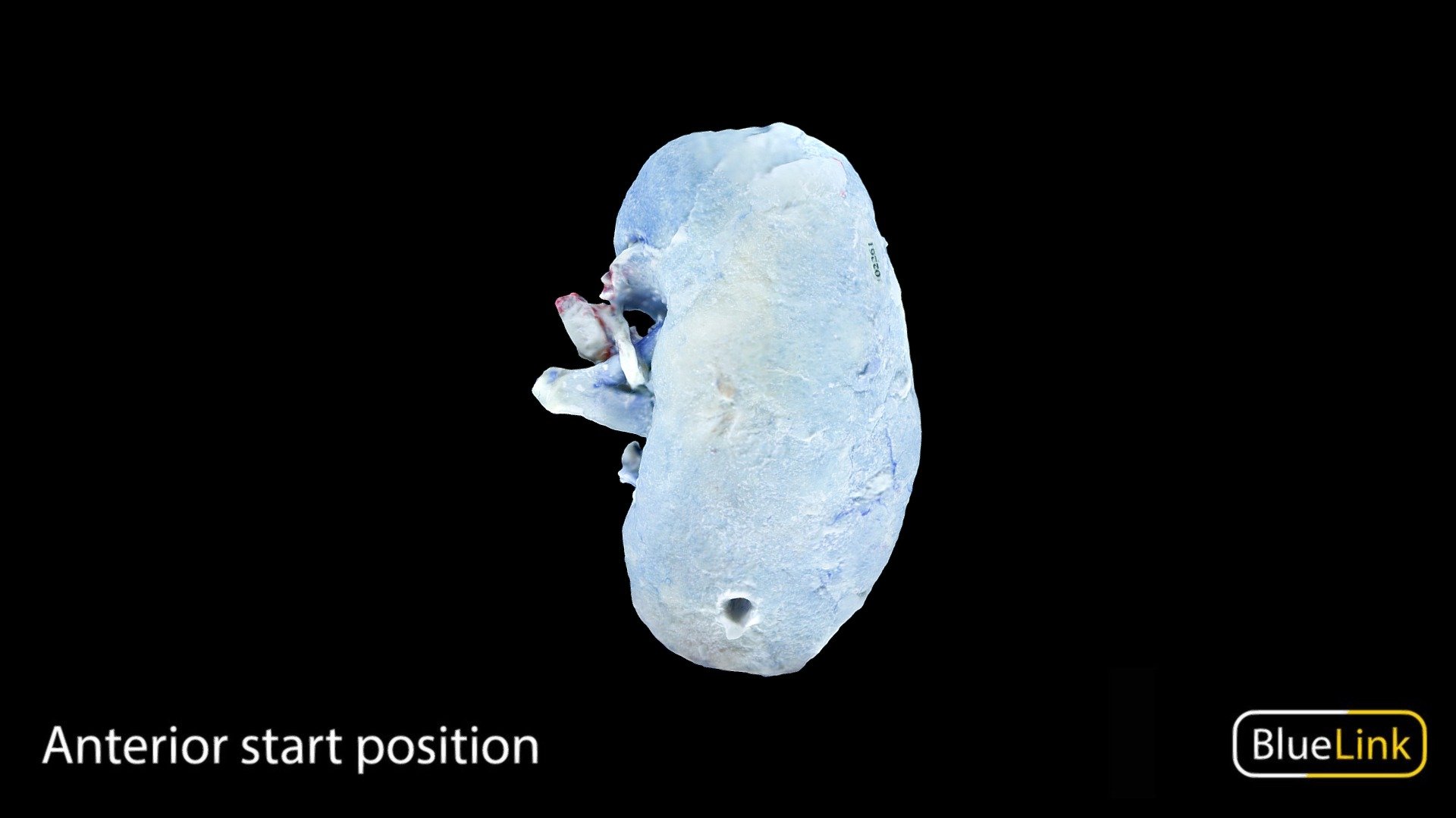 Bisected Blue Colored Kidney 3d model