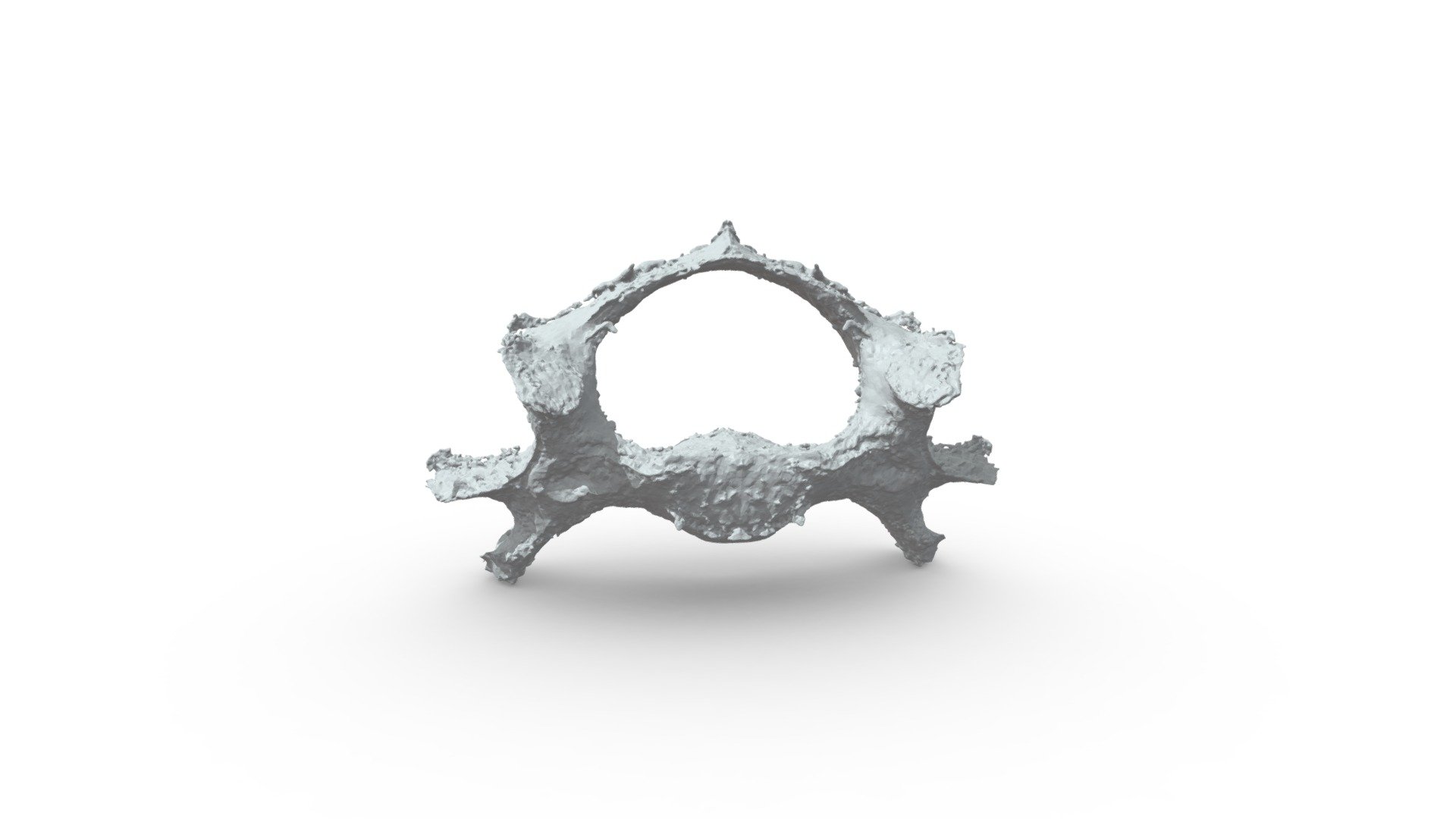 raw C6 vertebra scan 3d model