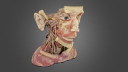 plastination 002 hi-res 2 chunks, mild mesh