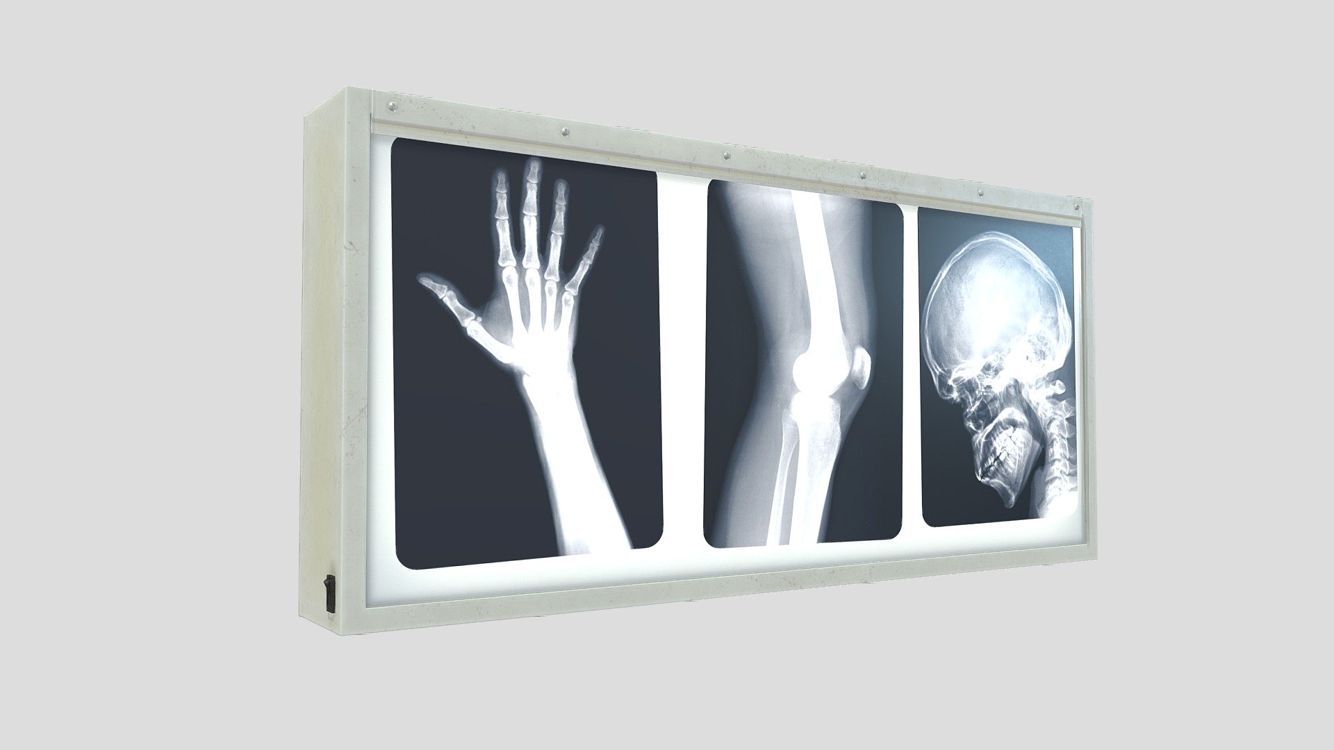 X-ray lightox 3d model